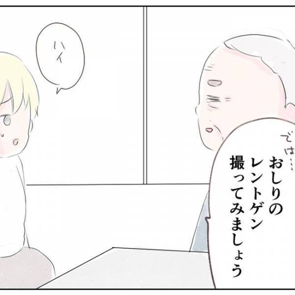 「ええええ！」おしりの激痛が1週間続き病院へ⇒するととんでもない事実が…＜出産で骨折した話＞