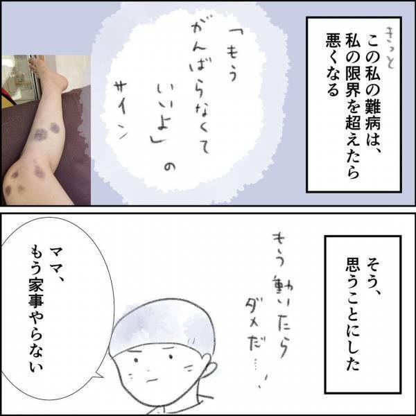 「自立したい」難病を抱え働けるのか模索する私。自分の個性が人生の転機に…＜夫の扶養から出る＞