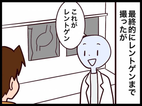 「娘が指輪を飲み込んだかもしれなくて…」慌てて病院に駆け込む妻。検査の結果は…！？
