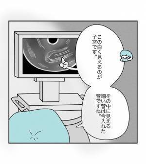 モニターに注目！ついに迎えた移植の瞬間！感動的な映像にじーんとくる… ＜原因不明不妊＞