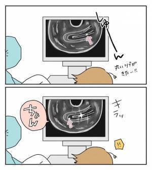 モニターに注目！ついに迎えた移植の瞬間！感動的な映像にじーんとくる… ＜原因不明不妊＞