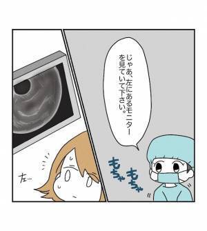 モニターに注目！ついに迎えた移植の瞬間！感動的な映像にじーんとくる… ＜原因不明不妊＞