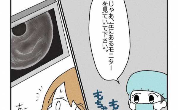 モニターに注目！ついに迎えた移植の瞬間！感動的な映像にじーんとくる… ＜原因不明不妊＞