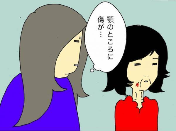 「顎に傷が…」もしかして転んだことも覚えていない？母の様子に一抹の不安が＜母の認知症介護日記＞