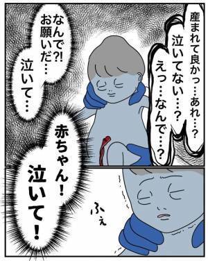 「泣かないし頭がテトリス型や…」19時間の格闘の末やっと生まれた娘！しかし反応なし…どうなる！？