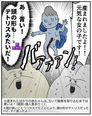 「泣かないし頭がテトリス型や…」19時間の格闘の末やっと生まれた娘！しかし反応なし…どうなる！？