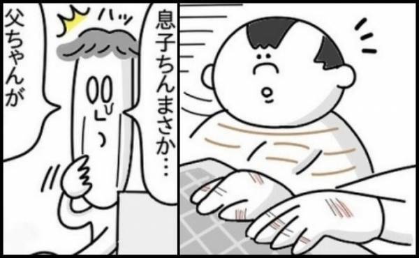 夫の手荒れに気付いた息子。予想だにしなかった驚きの行動に出て…！？