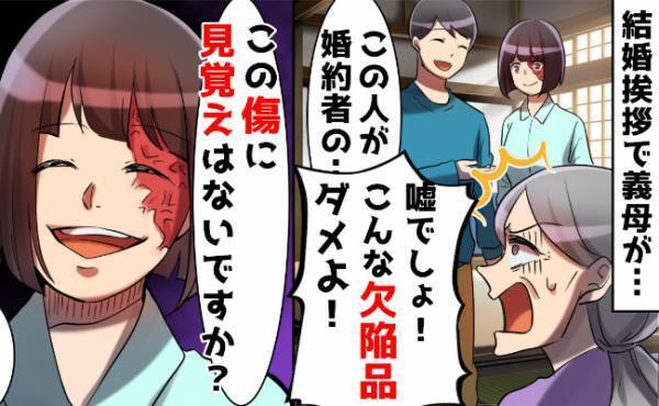 顔の傷を見て「欠陥品との結婚は許さん」→「この傷に見覚えはないですか？」義母が真っ青になったワケ
