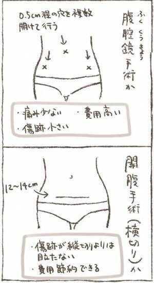 医師「かなり巨大化してます」子宮筋腫を7年近く温存させた結果…！？＜1268gの子宮筋腫＞