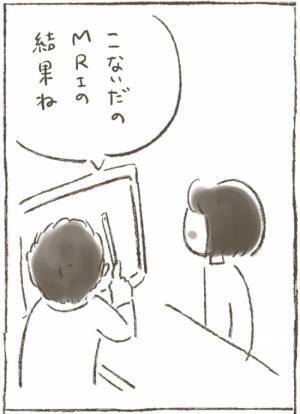 「妊娠を考えているのなら…」子宮全摘するか否かの2択に迫られて＜1268gの子宮筋腫＞