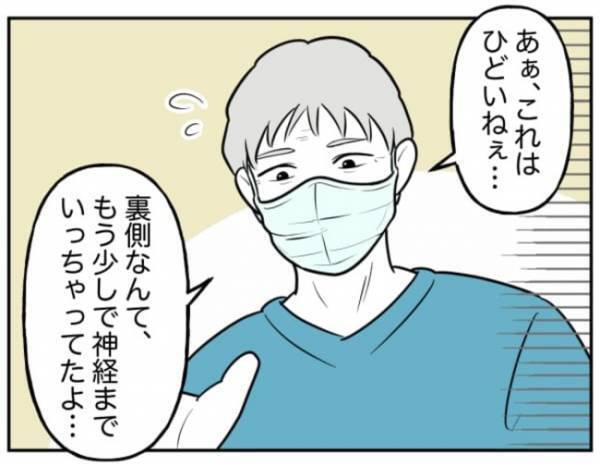 「何を言ってるんだ？」謝罪のはずが怒りを煽る加害者の親。非常識発言は止まらず…＜小学生トラブル＞