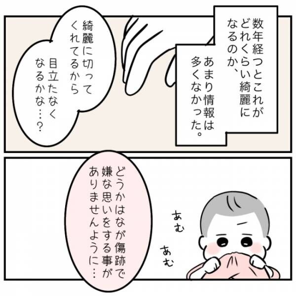 0歳で心室中隔欠損症の手術をした娘 11