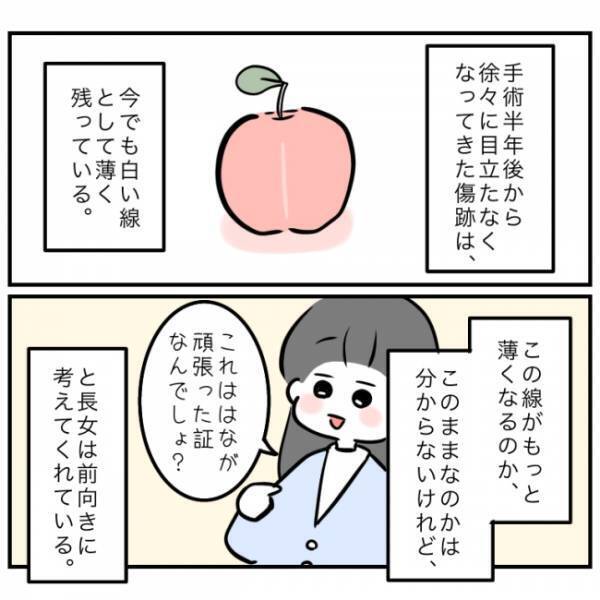 心臓の手術から7年が経過。無事に成長した娘を見て、ママが今思うことは…？