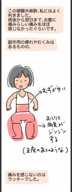 「1,268gでした」超巨大な子宮筋腫を取り除くことに成功！しかし…！？＜1268gの子宮筋腫＞