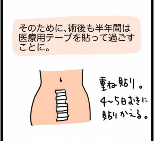 「1,268gでした」超巨大な子宮筋腫を取り除くことに成功！しかし…！？＜1268gの子宮筋腫＞