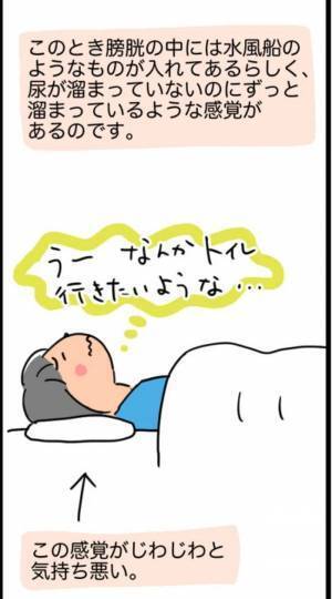 「1,268gでした」超巨大な子宮筋腫を取り除くことに成功！しかし…！？＜1268gの子宮筋腫＞