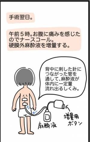 「1,268gでした」超巨大な子宮筋腫を取り除くことに成功！ただ術後が…！？ #子宮筋腫よさらば 6