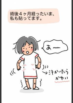 「1,268gでした」超巨大な子宮筋腫を取り除くことに成功！しかし…！？＜1268gの子宮筋腫＞