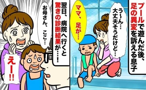 「お母さん、これは…」プールで遊んだ後、足の異変を訴える息子→翌日、受診すると驚きの診断結果が！