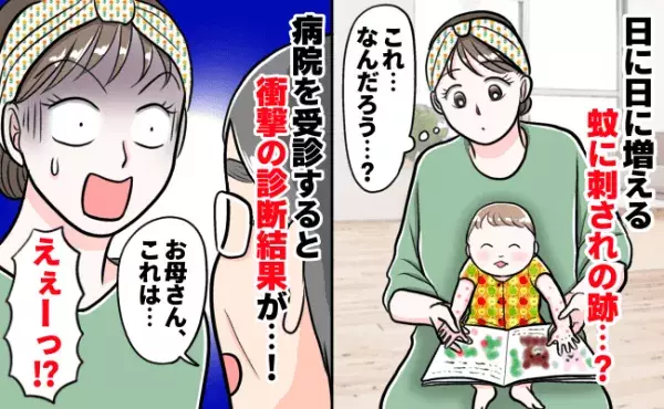 「お母さん、これは…」息子の異変！日に日に増える蚊に刺されの跡？→受診すると、衝撃の診断結果が！