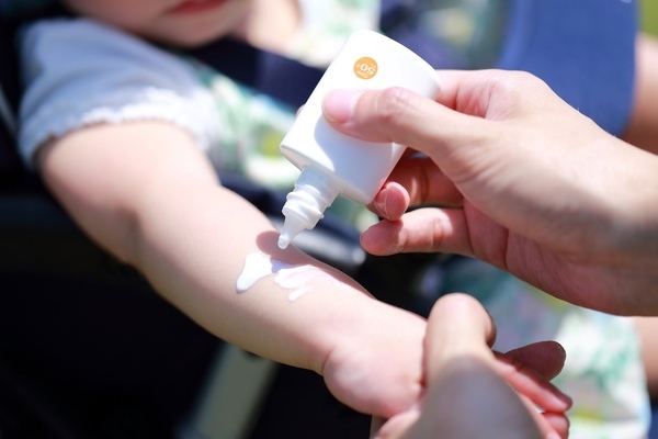 「日焼け止め、塗りすぎ注意」小児科医の忠告にドキッ…病気の原因に！？子どもの日焼け対策の落とし穴