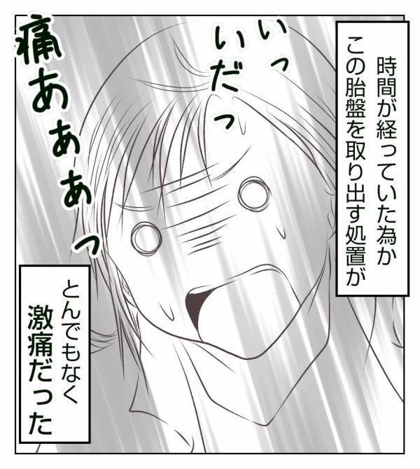 ＜真冬の車内で出産した話＞「い、痛すぎ…！」陣痛より痛い処置を乗り越えた矢先…