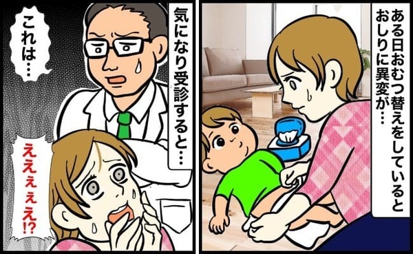 「え…穴がある？」おむつ替え中に気づいた子どもの異変。おしりにできた謎の穴の正体とは！？