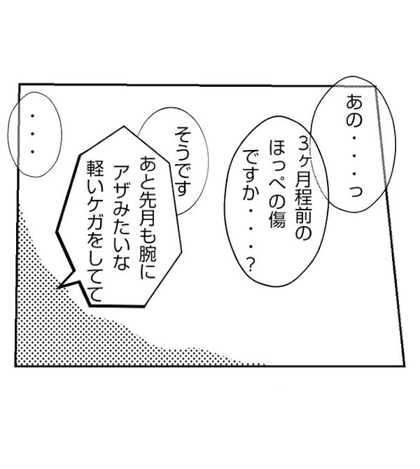 「先生は…」娘の怪我を保育園のせいにした妻→え…？妻の嘘が発覚！保育園では…＜妻が捨てたもの＞