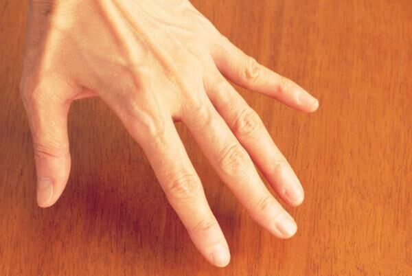 久々の再会で 老けた と驚かれてしまう8つの原因 17年6月21日 ウーマンエキサイト 2 3