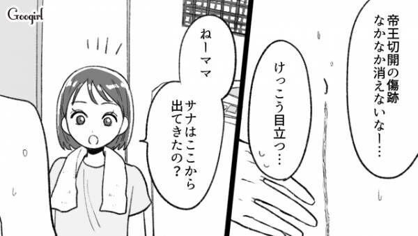 【漫画】帝王切開の傷はミミズみたいで気持ち悪い!?　無神経な夫を撃退！