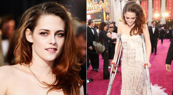 クリステン・スチュワート、「アカデミー賞」で松葉杖＆「ラジー賞」で最低女優に…