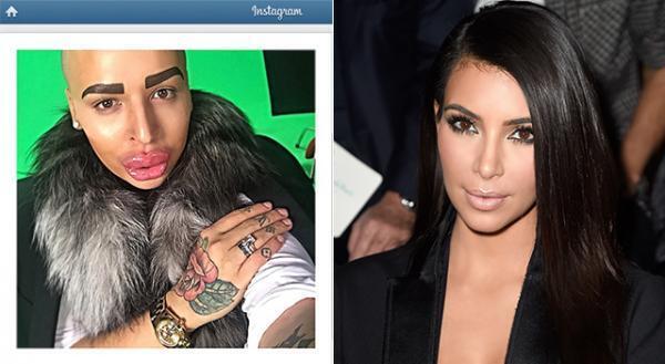 キム・カーダシアンそっくりに整形!? 話題の男性が真相を語る