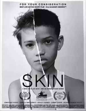 「Black Lives Matter」の高まり受け『SKIN』短編緊急配信