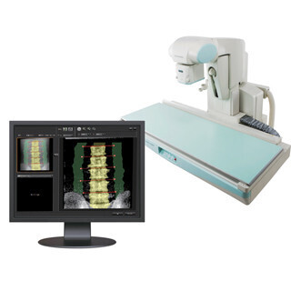 島津製作所、X線TVシステムに搭載して骨密度測定ができるシステムを発売