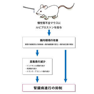 便秘薬による腸内環境の改善が慢性腎臓病の進行を抑制 - 東北大と慶大