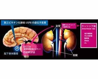 難病･クッシング病の原因遺伝子を発見、発症メカニズムを解明 - 東工大