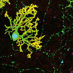 理研、ヒトES細胞から小脳の神経組織を作製 - 脳疾患の治療法開発に期待