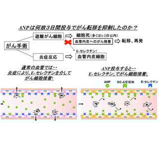 国循など、心臓ホルモンによるがん転移予防効果の仕組みを解明