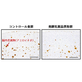 カマンベールチーズにアルツハイマー病を予防する効果 - 東大などが発表