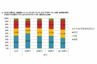薄毛でウィッグ着用に興味のある男性、50代の●%が定年を機にデビュー!?