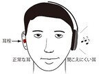 「突発性難聴」になった耳は使えば使うほど回復する - NIPSが新療法を開発