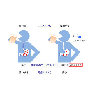L-システインの投与が胃がんのリスクを減らす!? - 東北大が確認