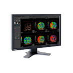 東芝、複数のモダリティに対応する医用画像処理ワークステーションを発売