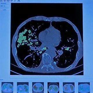 GTC 2015 - スタートアップの興味深い展示