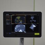 フィリップス、新型超音波診断装置を発表 - CT画像との位置合わせを自動化