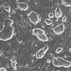 近大、ヒトES細胞をマウス胚に移植し分化させることに成功
