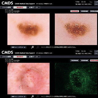 カシオ、皮膚の癌を判定する方法を学べる医師向けサービス