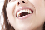 歯科医師が教える「自宅で簡単に歯を白く保つ方法」
