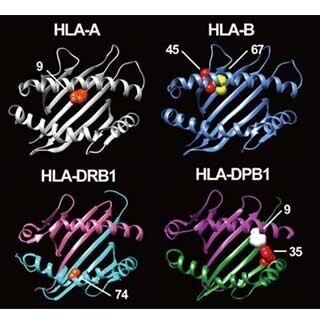 理研、バセドウ病の発症を予測可能にするバイオマーカーを同定