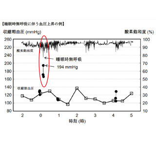 睡眠時無呼吸発生の際は、血圧が200mmHg以上まで上昇することを確認